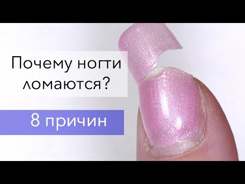 Почему гелевые / акриловые ногти ломаются? Что делать?