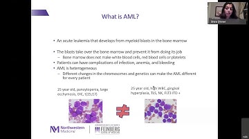 Acute Myeloid Leukemia