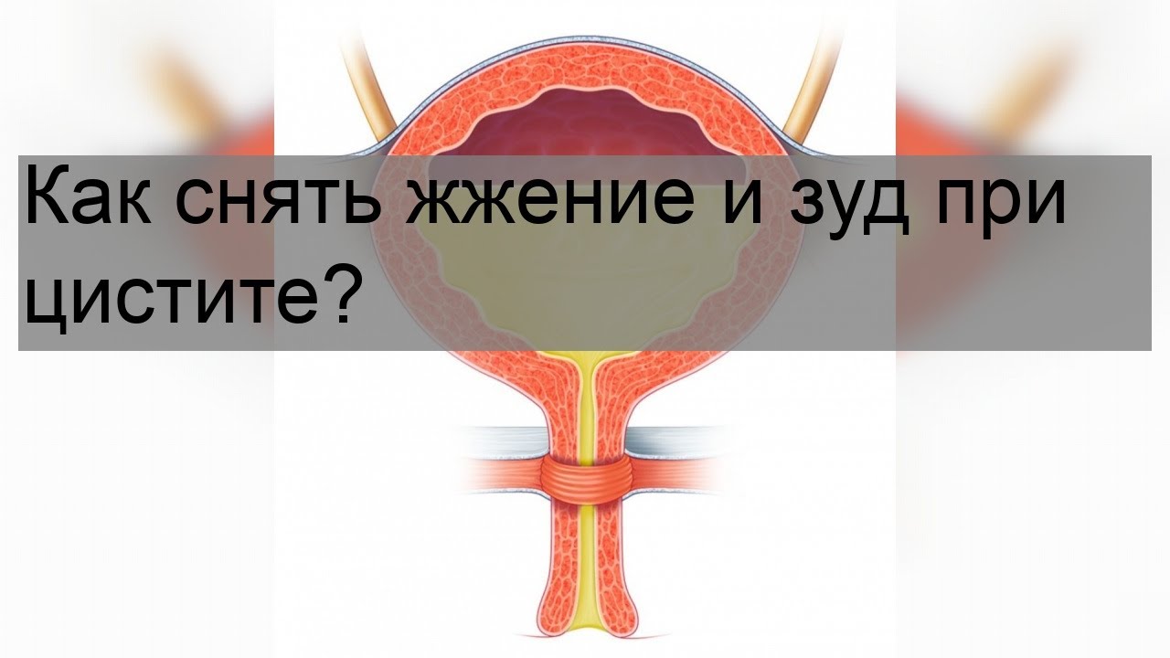 Жжение у мужчины в канале причины. Биопсия мочевого пузыря. Тур биопсия мочевого пузыря мужчин.