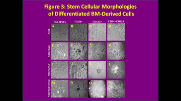 From a stem cell to a neuron – Video abstract 101001