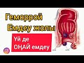 Геморрой үй жағдайында қалай емдейміз? Геморройды емдеудің оңай жолы.