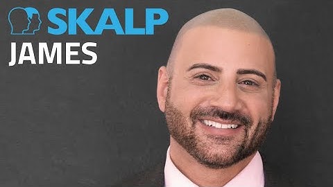 Before and after scalp micropigmentation with Skalp® James