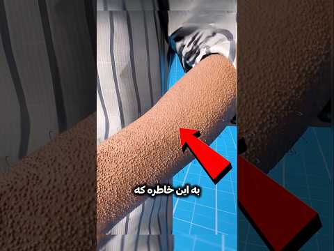 چرا یهو موهات سیخ میشه         
