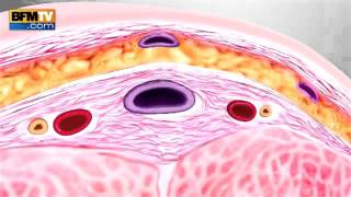 Bmftv -Crème Alprostadil