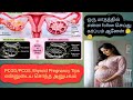 pcos pregnancy tips in tamil/how to overcome pcos naturally and get pregnant in tamil#pcos#pcod tips