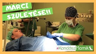 hogy a gyengén látó emberek hogyan szülnek a látásromlás eltérés