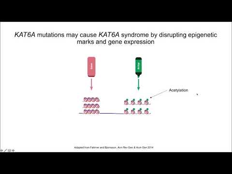 Video: Viis Uut Sündroomi Intellektipuude Juhtu, Mis On Tingitud KAT6A Mutatsioonidest: Molekulaarse Ja Kliinilise Spektri Laiendamine