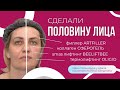 Сравни половинки лица! Beelift + Oligio + Филлеры + сферогель комплекс anti-age за 1 визит!