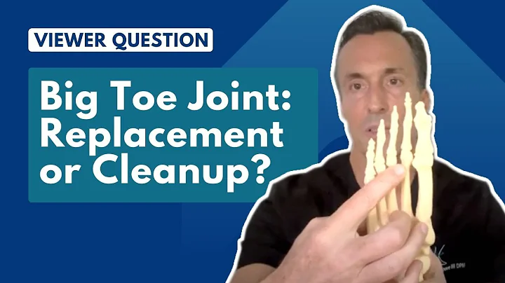 Big Toe Joint Replacement vs. Joint Cleanup | Ask Dr. Moore