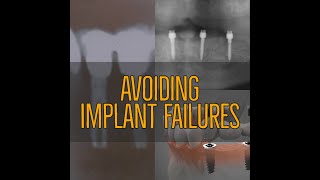 Avoiding Implant Failures and How to Treat Them