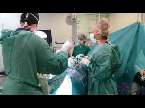 REARTROSKOPIJA oštećenog meniskusa - dr Miodrag Glišić - Analife