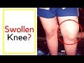 What to do with swollen knee joint injury that causes swelling, inflammation and knee pain