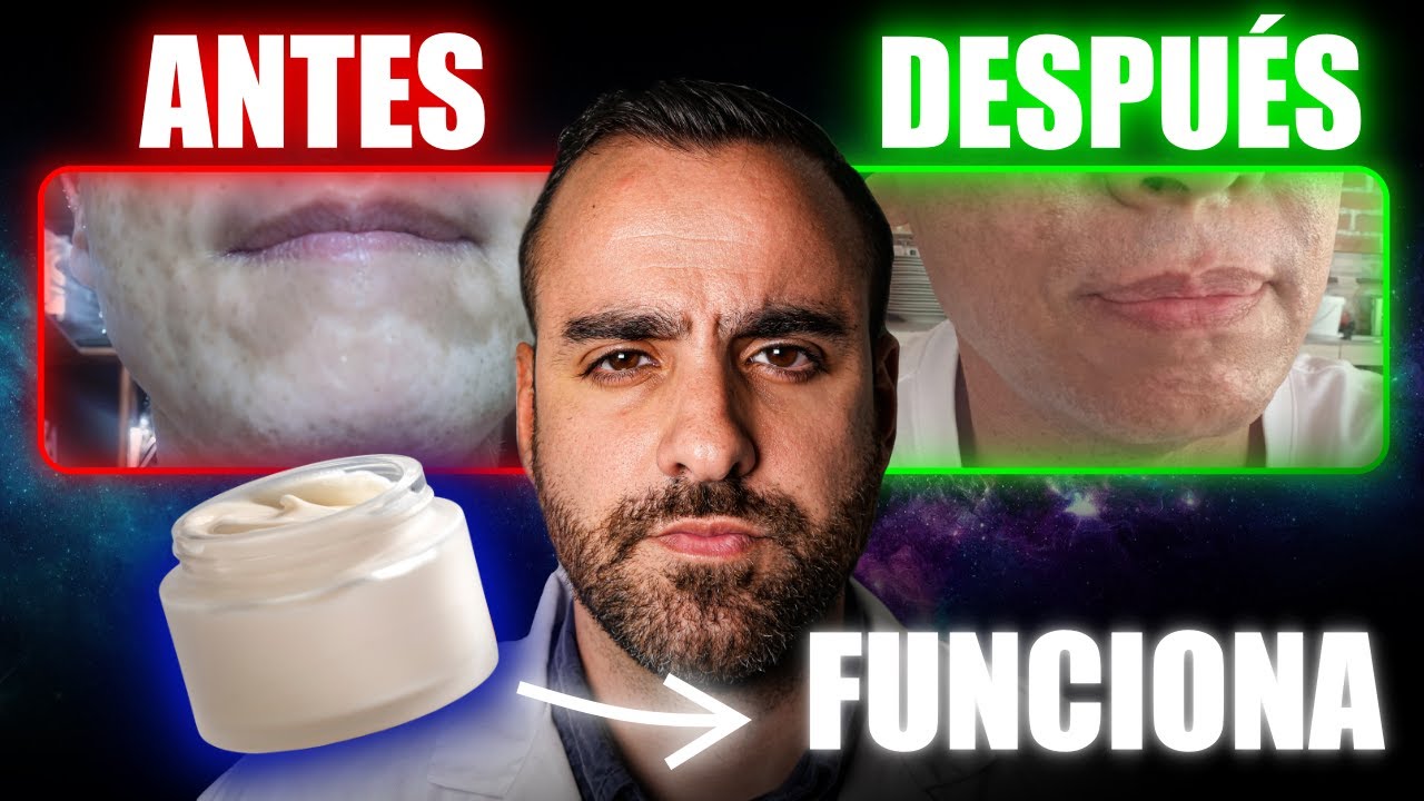 Estas 3 Cremas ayudan a RECUPERAR el color de tu Piel (y nadie te lo había dicho así)