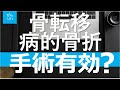 【がんリハ/38話】骨転移を有する患者に対して病的骨折が生じた後に手術療法を行うことは推奨されるか？