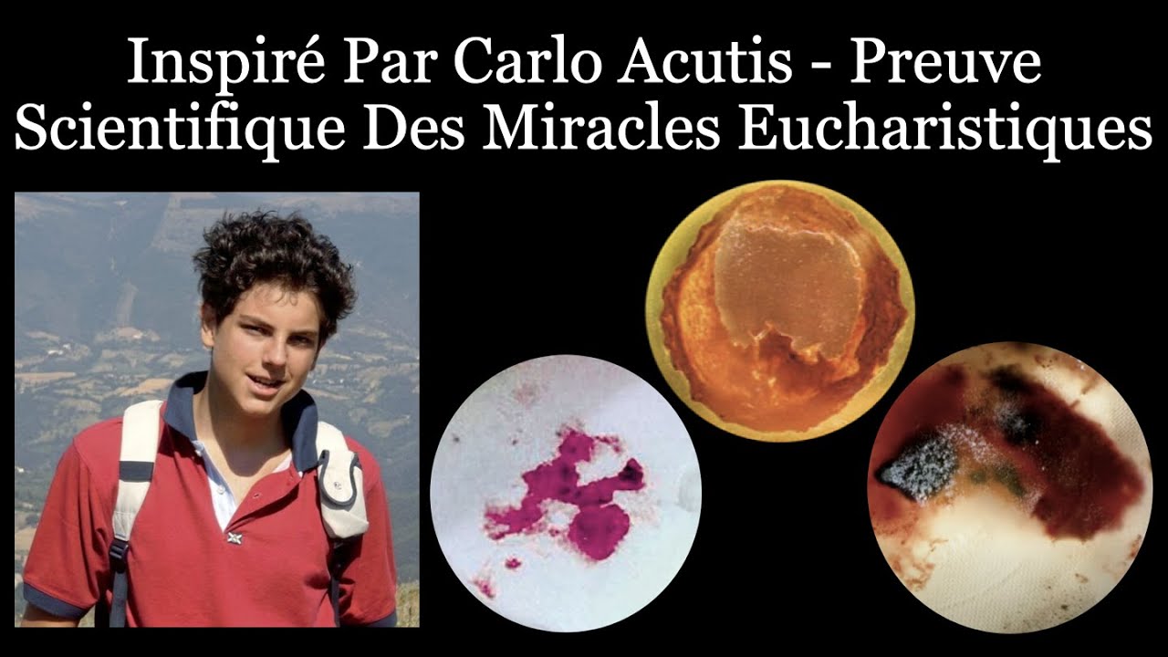 Visitez ce très beau site sur les miracles eucharistiques... Maxresdefault