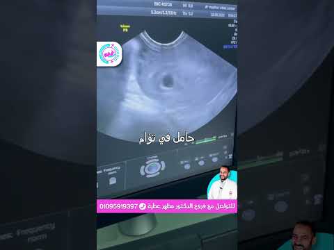 حامل في 2 تؤام مبروووووك