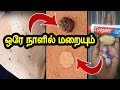 ஒரே நாளில் மருக்கள் மறையும் இப்படி பண்ணா | marukkal poga tips in tamil