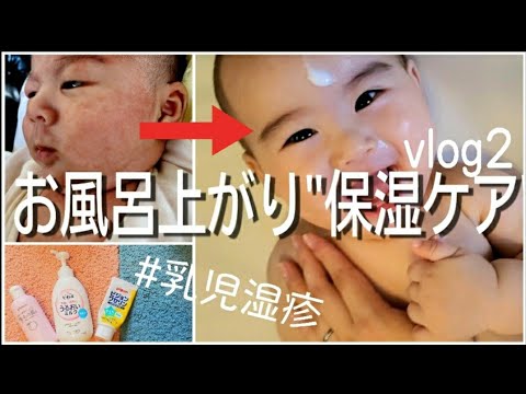 乳児湿疹が治る 保湿 のコツ 赤ちゃんお風呂上がりのスキンケア 看護師ママが伝授 ルーティンvlog 2 5 Month Old Baby Youtube 乳児湿疹が治る 保湿 のコツ 赤ちゃんお風呂上がりのスキンケア 看護師ママが伝授 ルーティンvlog 2 5 Month Old Baby Youtube