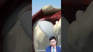 The Clinical Efficacy Of The Regeneten Bioinductive Implant In Rotator Cuff Repair