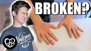 Another Kid Broken Bone | Is it Broken or Sprained? | His First Broken Bone?