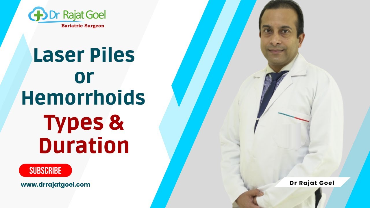 Laser Piles or Hemorrhoids Surgery in Delhi Types and Duration