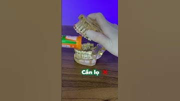Những thứ không nên làm khi đang niềng răng #shorts #nhakhoathuyanh #niengrang #nhakhoa
