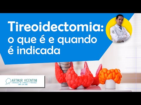 Vídeo: O que significa tireoidectomia?
