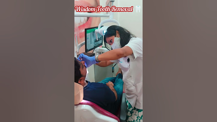 अकल दाढ़ कैसे निकालते हैं? |Akal Dadh Ka Dard |Wisdom Teeth Pain |Akal Dadh Nikalwane Ka Kharcha