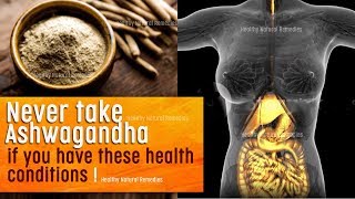 Never take Ashwagandha if you have these health conditions | Dosage, Time, Uses, Side effects