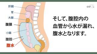 201408 3 551ことばと健康 ことわざ 覆水盆に返らず