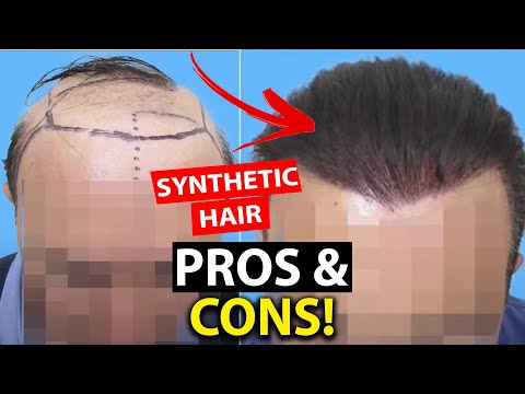 Synthetic Hair Implants, Pros and Cons of Artificial Hair , Before and after