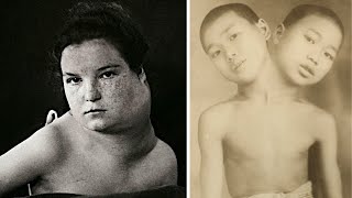15 Real Circus Freaks That Actually Exist