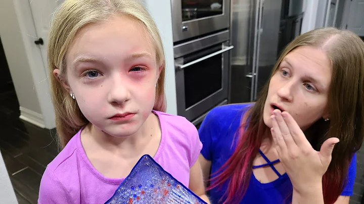 Trinity Has an Allergic Reaction!!! Her Eye is Swo...