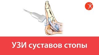 УЗИ суставов стопы