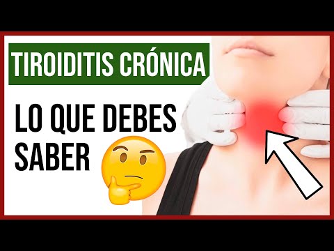 Si tienes estos