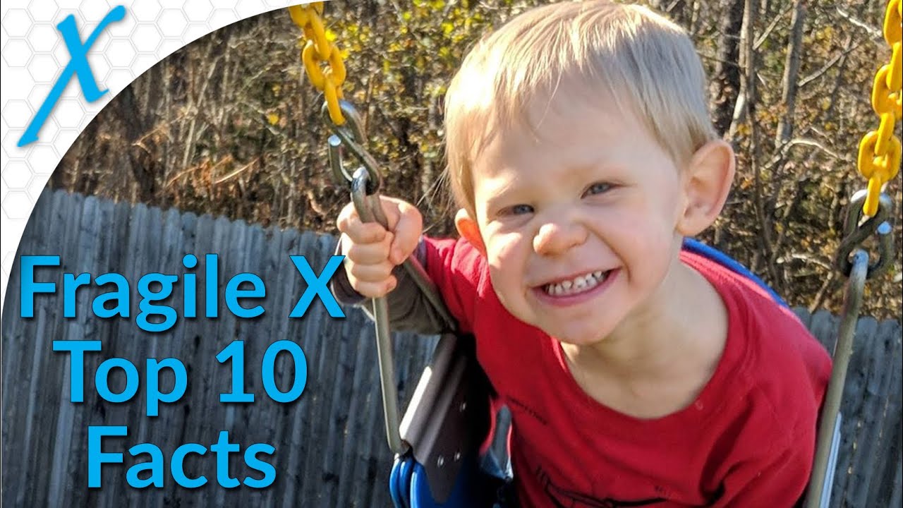 Fragile X Syndrome (FXS) 10 Things You Did Not Know - YouTube