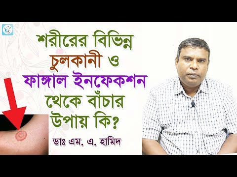 শরীরের বিভিন্ন চুলকানী ও ফাঙ্গাল ইনফেকশন থেকে বাঁচার উপায় কি? Some Common Fungal Infections!