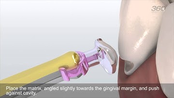 360° Cervical Matrix for Composite) Animation