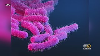 Doctors warn of drug-resistant stomach bug 'shigella'