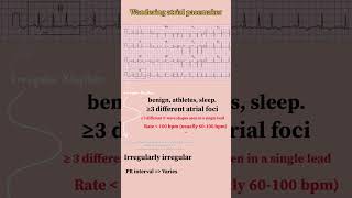 #shorts  #ecg wandering atrial pacemaker WAP X  Multifocal atrial tachycardia MAT  #medicine 