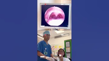 Inside the Throat: Endoscope Reveals What’s Hidden! 👅🔍 #ThroatCheck #DoctorView