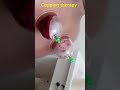 Cupping therapy #shorts