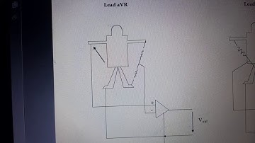 EL 306 Unit 4  ECG Lead  configuration Heart rate  measurement  by Ruchi Hirdani  GPC Pali