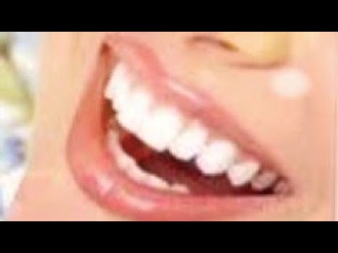 فيديو: 3 طرق سهلة لتقليل حموضة الفم