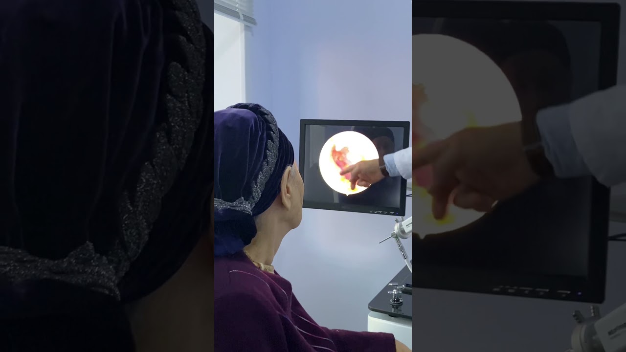 Лор-сурдолог врач в Караганде. - YouTube