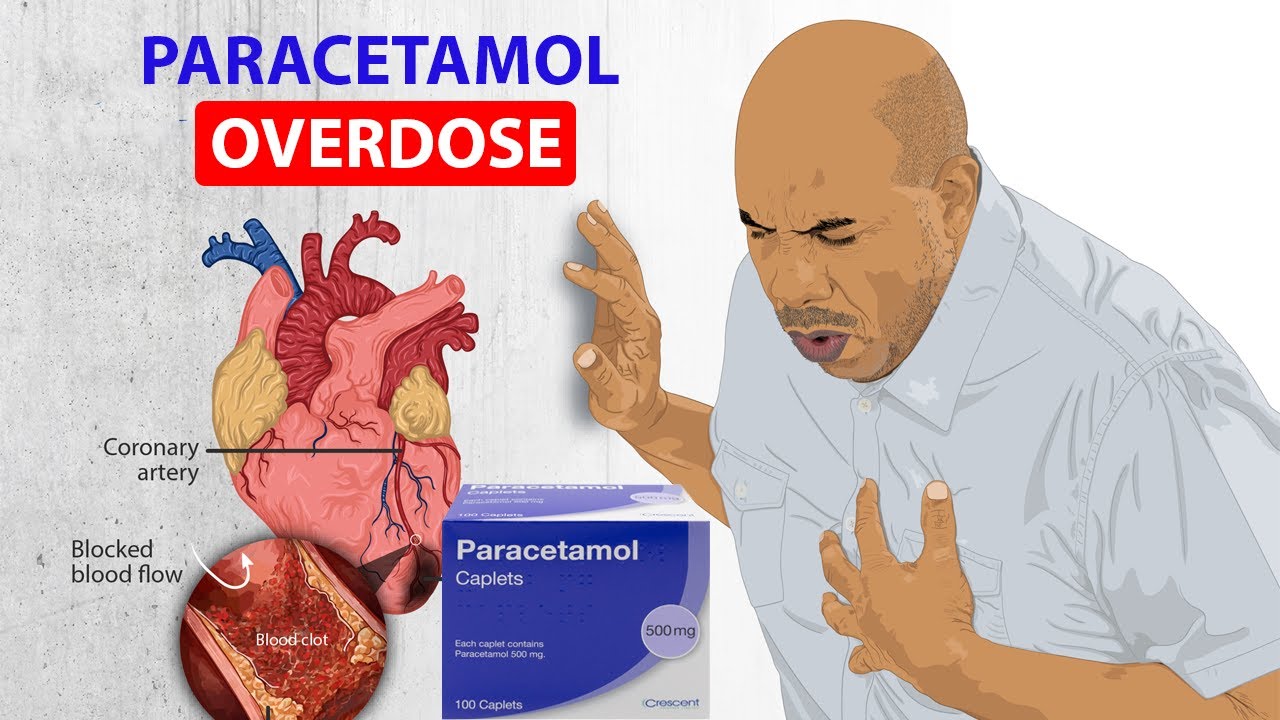 Paracetamol overdose Causes Heart attack │ Side effects of Paracetamol