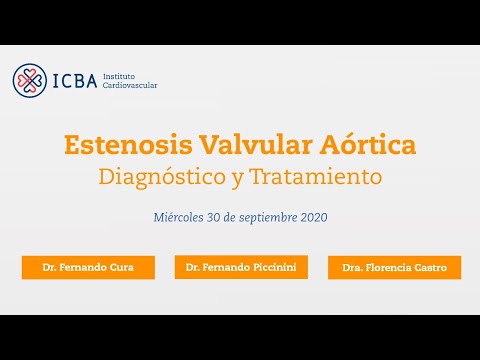 Vídeo: Estenosis De La Válvula Mitral: Causas, Síntomas Y Diagnóstico