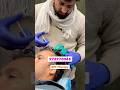 GFC therapy for Hair Fall intenance treatment after transplant At Aayat Clinic, Shamli UP #shorts