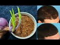 गंजापन खत्म कर नए बाल उगा देगा ये जबर्दस्त चीज | hairfall control tips | hair regrowth home remedy