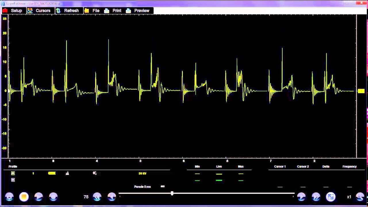 Msd Ecurve secondary ignition patterns YouTube
